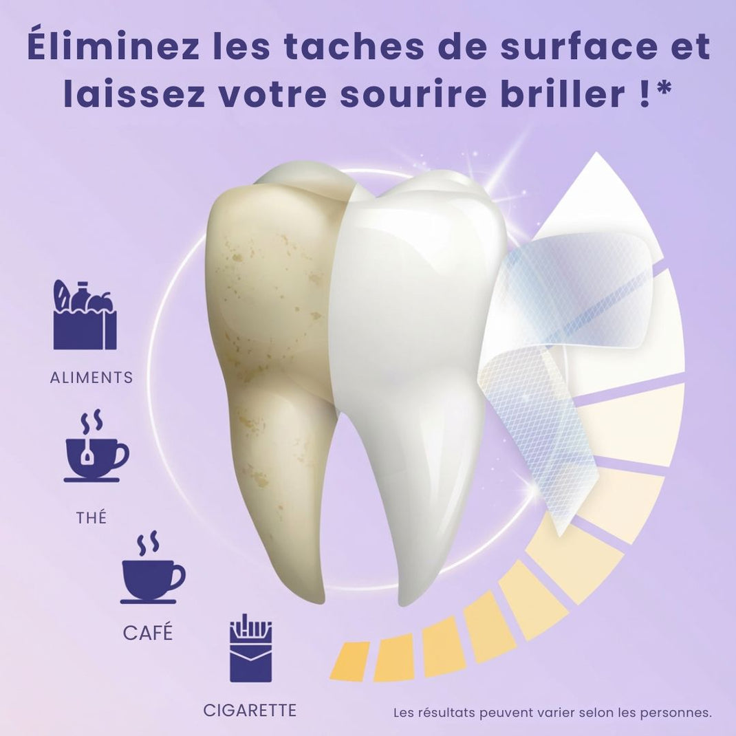 Bandes Blanchissantes – PAP+ Sans Peroxyde | SmileLab
