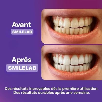 Bandes Blanchissantes – PAP+ Sans Peroxyde | SmileLab