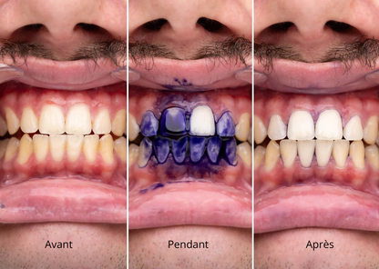 Sérum correcteur de couleur V34